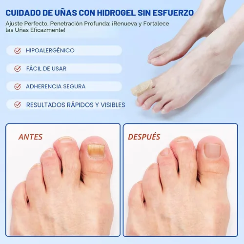 Miniatura 4 de Parches de uñas, 21 unidades, tratamiento de uñas de los pies, extra fuerte, 8 horas durante la noche, reparación de uñas de acción rápida, hidrogel