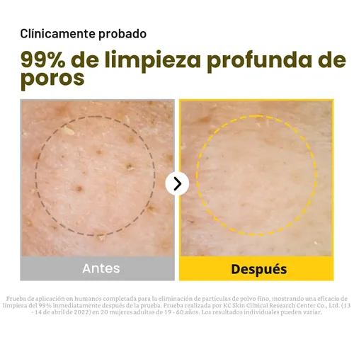 Miniatura 5 de MANYO Aceite de Limpieza Puro Limpiador Facial Coreano, Derrite Puntos Negros, Eliminación Diaria de Maquillaje con Aceite de Argán, Cuidado
