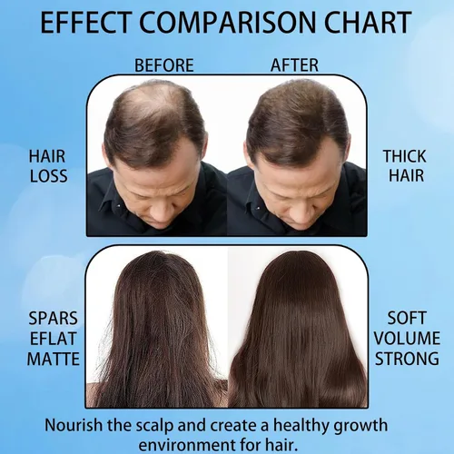 Miniatura 4 de Rollo de suero de crecimiento del cabello, rollo de romero para el crecimiento del cabello, suero avanzado para el crecimiento del cabello, cabello