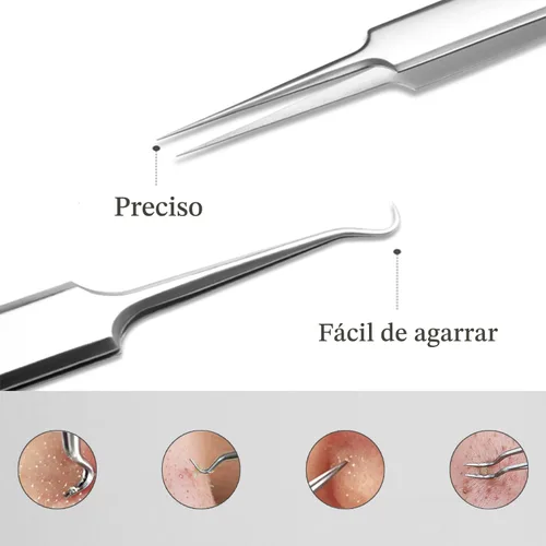 Miniatura 5 de Pinzas profesionales para eliminar puntos negros, 3 piezas, kit de herramientas de precisión para espinillas y manchas, comedones, herramienta