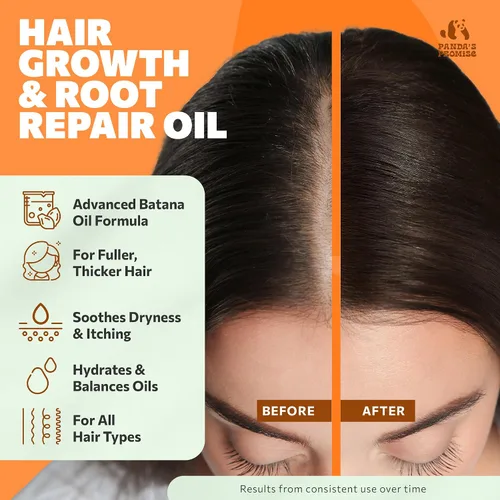 Miniatura 2 de Panda's Promise Aceite de batana puro de Honduras, mezcla vegana y prensada en frío con aceite hidratante para el cabello de romero y ricino para un