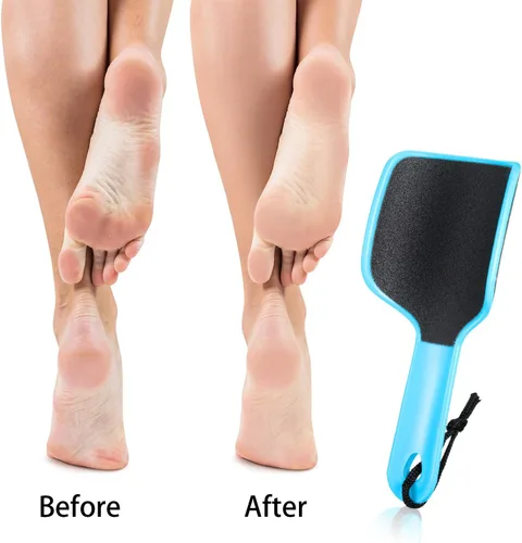 Miniatura 6 de Mudder 4 piezas de lima curvada en forma de U, removedor de callos de pie de doble cara, colosal para grano, exfolia elimina la piel muerta, 4