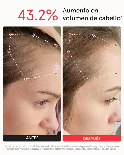 Miniatura 7 de iRestore - Sistema para crecimiento del cabello + baterías recargables, gorra láser aprobada por la FDA (Administración de Alimentos y Medicamentos)