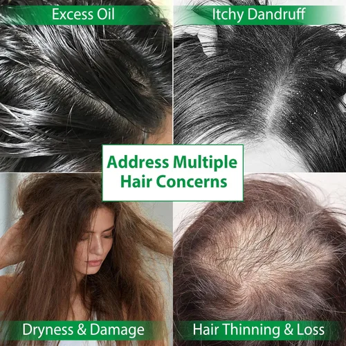 Miniatura 5 de Batana Oil - Juego de champú y acondicionador para el crecimiento del cabello, champú para adelgazar el cabello para mujeres y hombres, hidrata