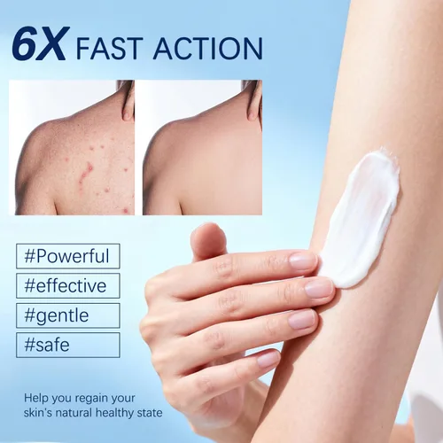 Miniatura 4 de Crema de foliculitis Alivia y ayuda a eliminar protuberancias en el cuero cabelludo, la cara, el cuerpo y los glúteos para pelos encarnados