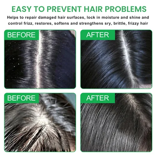 Miniatura 4 de Barra de champú sólida hecha a mano – Barra de champú natural y acondicionador para cabello seco, nutrición del cabello, evita puntas derramadas