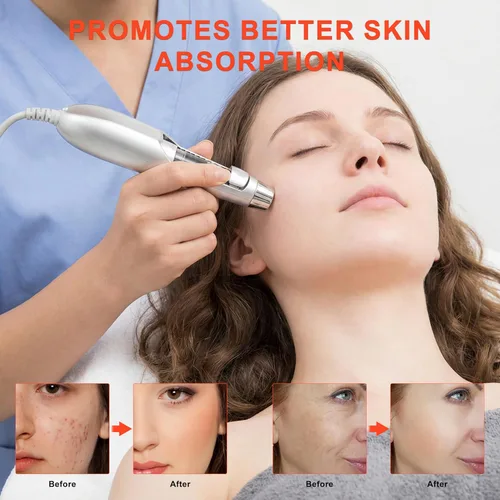 Miniatura 6 de Elitzia ETF49E Dispositivo facial de electroporación sin aguja, máquina de belleza facial importadora de iones de mesoporación, eliminación