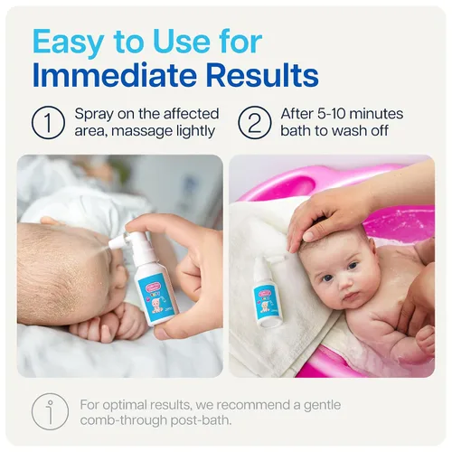 Miniatura 3 de NAVEH PHARMA Limpiador de tapa de cuna para bebés y niños Tratamiento de tapa de cuna 100% natural Spray y lavado sin fregar Mejor que