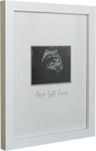 Miniatura 9 de Sonogram - Marco de fotos para abuela, marco de fotos de ultrasonido, anuncio de embarazo para abuela, ideas de anuncio de bebé, marco de fotos