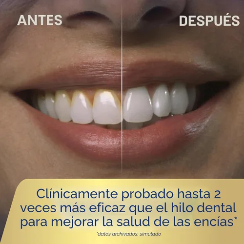 Miniatura 6 de Waterpik ION - Irrigador dental profesional, recargable y portátil para dientes, encías, aparatos ortopédicos, 10 ajustes, 7 puntas de irrigación