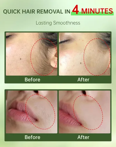 Miniatura 3 de Crema de depilación facial sin dolor para mujeres - Kit 2 en 1 con crema calmante para piel sensible Removedor de vello de labio superior