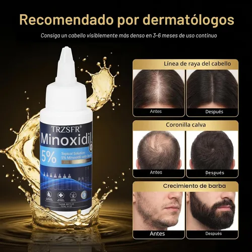 Miniatura 3 de Minoxidil - 5% para hombres y mujeres con aplicador de rodillo y bolígrafos aplicadores de precisión, solución tópica extra fuerte