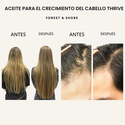 Miniatura 2 de Forest & Shore Aceite para el crecimiento del cabello, 100% natural, con cafeína, biotina, ricino, argán y romero, suero eficaz para cabello dañado