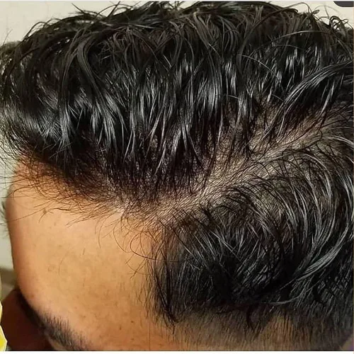 Piel súper ultra fina 0.001 in 90% densidad indetectable línea capilar natural hombres tupé marrón negro 100% cabello humano (#1, negro azabache,