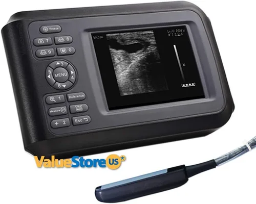 Escáner de ultrasonido portátil V16 para embarazo veterinario con sonda rectal de 7.5 MHz para ganado, caballo, camello, equino y vaca.