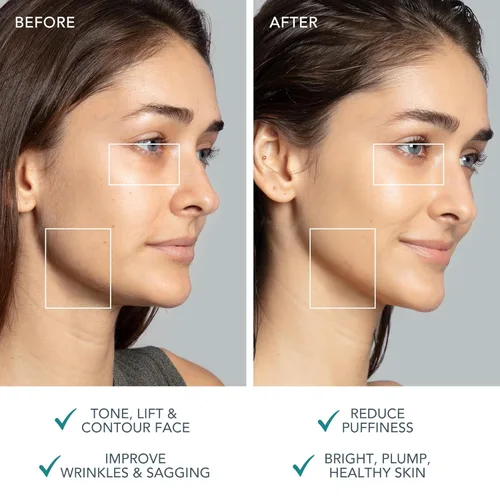 Miniatura 5 de FOREO Bear 2 Dispositivo Facial Avanzado de Microcorriente para Lifting y Tonificación - Herramienta de Esculpido Facial - Reafirma y Contornea - No