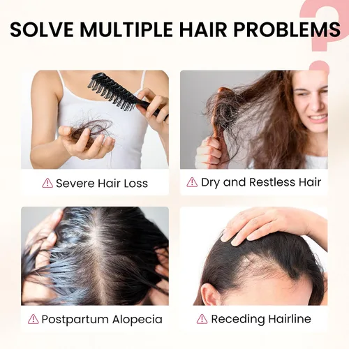 Miniatura 3 de Suplemento para el crecimiento del cabello, apoyo para el cuidado del cabello para fortaleza, crecimiento de espesor, con biotina vitamina A, C, E
