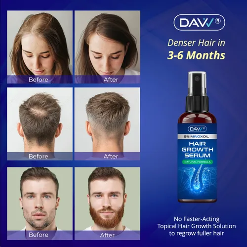 Miniatura 2 de 5% de minoxidil para mujeres y hombres: paquete de 2 productos de crecimiento del cabello de minoxidil - Minoxidil para hombres - suero de biotina