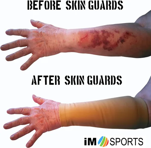 Miniatura 2 de SKIN GUARDS - Mangas de protección para la piel del antebrazo, protege el envejecimiento o la piel fina, protección UV, unisex, fabricadas en Claro