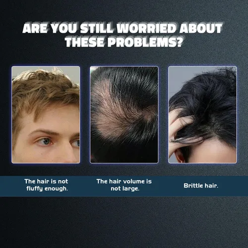 Miniatura 3 de Crecimiento del cabello de minoxidil al 5% para hombres y mujeres: rebrote tópico del pelo de la barba de minoxidil más grueso previene la pérdida