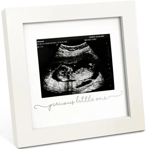 KeaBabies Portarretratos de ecografía para bebé, modernos marcos de fotos de ultrasonido para mamá, regalos de primer embarazo para futura mamá y