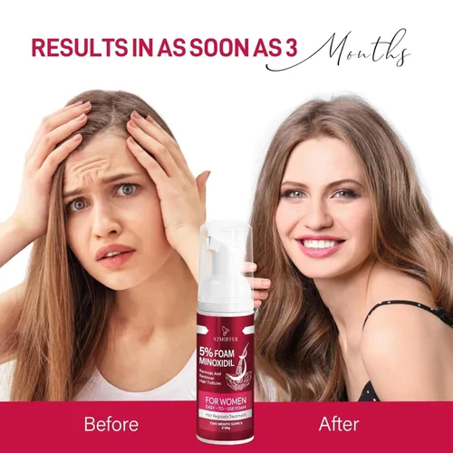 Miniatura 5 de Espuma de Minoxidil para el Crecimiento del Cabello en Mujeres: 5% Minoxidil como Tratamientos para la Caída del Cabello en Mujeres y Productos