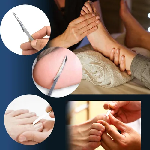 Miniatura 5 de 6 herramientas de uñas encarnadas, lima y levantadores de uñas de los pies, kit de herramientas profesionales de eliminación de uñas de acero