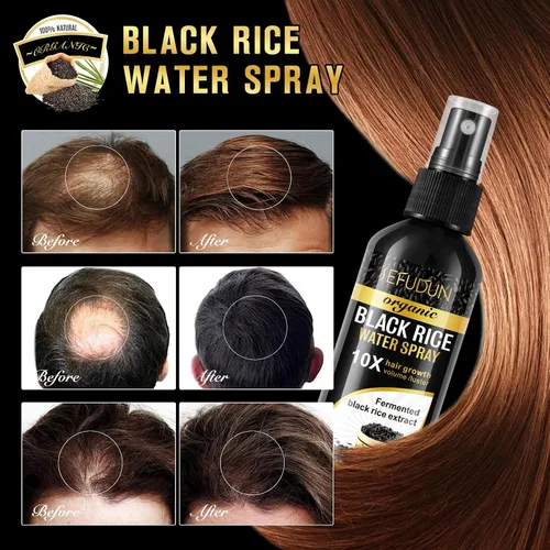Miniatura 4 de Spray de agua de arroz negro orgánico para el crecimiento del cabello, una solución con aceite de ricino y extracto de raíz de jengibre para cabello