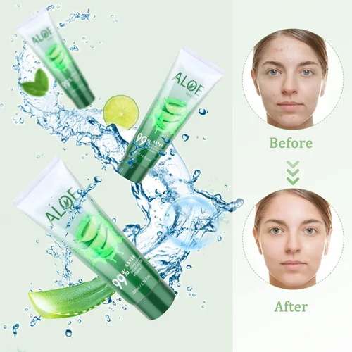 Miniatura 5 de Gel de aloe vera de 200 x 0.1 fl oz, 99% orgánico puro aloe vera hidratante facial y corporal, crema de aloe natural para piel seca, quemaduras