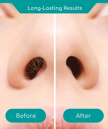 Miniatura 3 de Medi Grade Kit de depilación nasal para hombres y mujeres con barra de cera reutilizable, 1.76 onzas, juego ecológico para eliminar vello de nariz