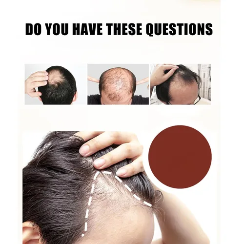 Miniatura 2 de Crema de masaje de cuero cabelludo de minoxidil al 5 % para el crecimiento del cabello, crema de minoxidil profesional, rápido crecimiento y 2 pzas