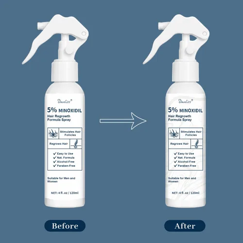 Miniatura 2 de 5% de minoxidil para hombres y mujeres, tratamiento para el crecimiento del cabello y la barba con biotina y romero para adelgazamiento y pérdida