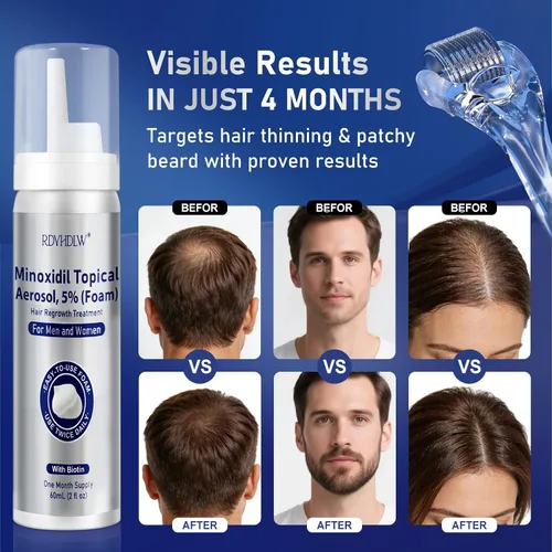 Miniatura 3 de Espuma de minoxidil al 5% para hombres y mujeres, crecimiento del cabello, espuma de minoxidil para hombres para cabello y barba, tratamiento