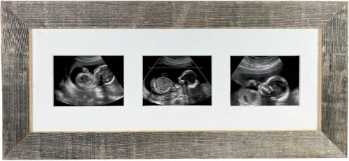 Miniatura 5 de BARNWOODUSA Marco de fotos Sonogram Marco de fotos de recuerdo de progresión de ultrasonido de bebé Marco de fotos de hitos del embarazo 1