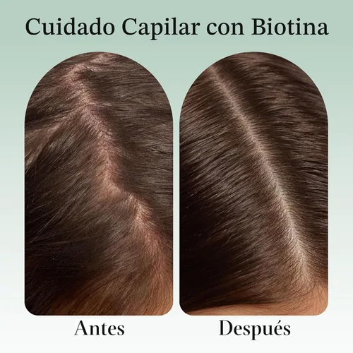 Miniatura 4 de Kitsch Aceite de romero para el crecimiento del cabello – Aceite para el cabello con biotina, ricino y jojoba – Aceite de cuero cabelludo prelavado