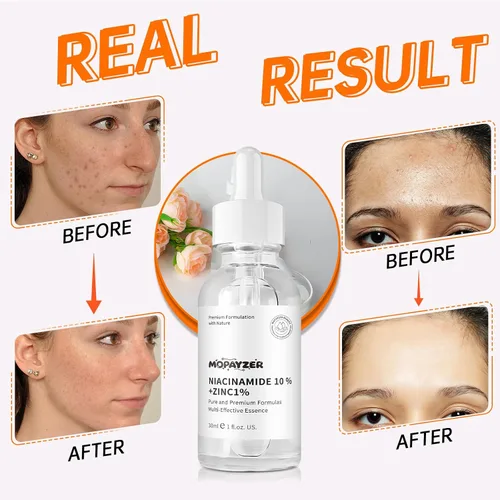 Miniatura 7 de Suero de niacinamida 10% + 1% de zinc, suero de niacinamida antienvejecimiento para cara, 1 suero facial hidratante para todo tipo de piel, cuidado