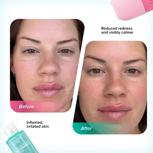 Miniatura 6 de Contour Cube Mini rodillo de hielo revolucionario para esculpir y deshinchar - Rodillo de hielo facial y masajeador - Molde de hielo para la cara