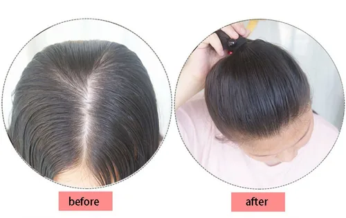 Miniatura 7 de 2 clips en la parte superior de cabello humano con cierre de peluca para cabello fino de 10 pulgadas para mujer (marrón oscuro)