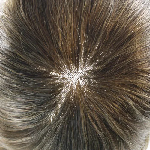 Miniatura 6 de Toupee - Pieza de cabello humano real para hombre, sistema de reemplazo de encaje suizo suave para hombre, pieza de pelo tipo tupé, protesis capilar
