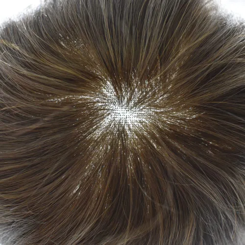 Miniatura 188 de Sistema de repuesto de cabello humano europeo con encaje frontal suizo para hombre, tupé para hombre, pieza de cabello, nudo blanqueado, línea #17