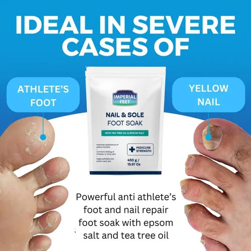Miniatura 7 de Imperial Feet Epsom Salt Foot Soak (grado pedico): reparación de uñas de los pies, pie de atleta de hongos, suaviza callos, pies cansados y Verde