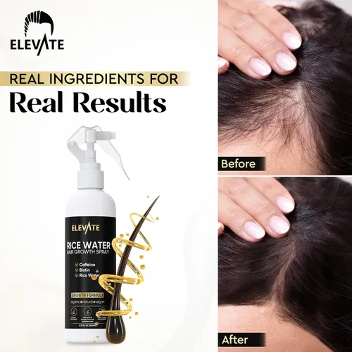 Miniatura 3 de Elevate Spray para el crecimiento del cabello con agua de arroz, infundido con biotina, cafeína y aloe vera para un cabello más grueso, más largo