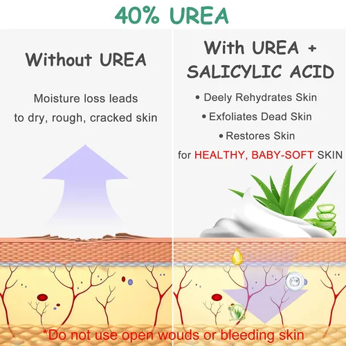 Miniatura 3 de Crema de urea 40 por ciento para pies, crema para pies, 40% loción de urea para piel seca/talones agrietados/pies ultra callosos, suaviza la piel