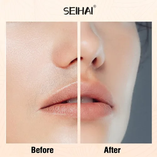 Miniatura 6 de Depilación facial para mujeres, dispositivo de depilación, removedor de pelo recargable SEIHAI para mujeres, removedor de vello facial para cara