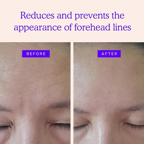 Miniatura 3 de Blumbody Parches antiarrugas para la frente, parches faciales antiarrugas para suavizar los ojos y las arrugas de la frente, cinta facial sin