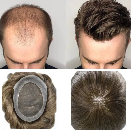 Miniatura 18 de Toupee para hombres, centro de encaje francés, extensiones de cabello humano, sistema de reemplazo de encaje con piel fina, prótesis de cabello gris