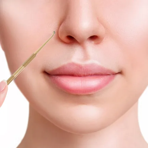 Miniatura 9 de Lurrose Herramienta extractora de comedones de acero inoxidable, removedor de cabeza negra, limpiador de poros, agujas de belleza ocultas