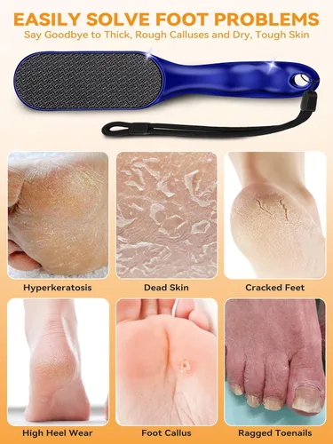 Miniatura 5 de Lima de pie de nanocristal, raspador profesional de pies para piel muerta, removedor de callos de pies húmedos y secos, herramientas de pedicura