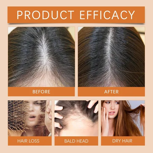 Miniatura 5 de Ampollas para el Crecimiento del Cabello, aceite de regeneración del cabello, repara y promueve el crecimiento del cabello, ampolla de fuerza