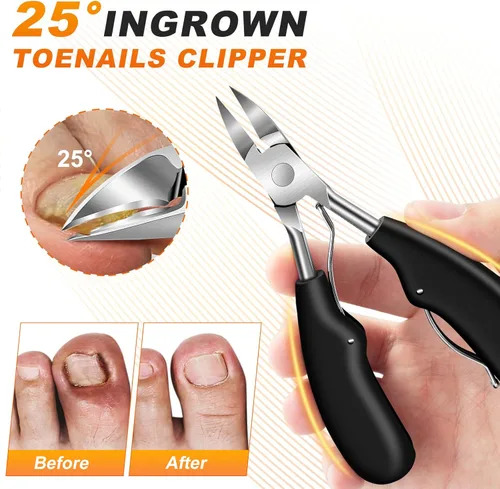 Miniatura 4 de Cortaúñas para uñas gruesas de los pies, cortaúñas en ángulo con atrapasueño, cortaúñas giratorio de 360° para hombres, cortador de uñas de apertura